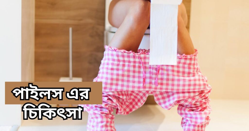 পাইলস এর চিকিৎসা piels er chikitsha